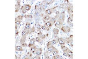 Immunohistochemistry of paraffin-embedded human liver using BAAT Rabbit pAb (ABIN6131367, ABIN6137411, ABIN6137412 and ABIN6223563) at dilution of 1:500 (40x lens). (BAAT antibody  (AA 309-418))