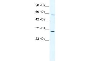 WB Suggested Anti-GATAD1 Antibody Titration: 0. (GATAD1 antibody  (C-Term))