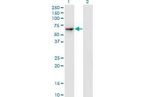 Western Blot analysis of ZNF350 expression in transfected 293T cell line by ZNF350 monoclonal antibody (M01), clone 1A9. (ZNF350 antibody  (AA 1-532))