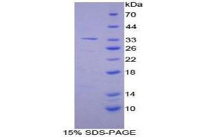SDS-PAGE (SDS) image for Alanine Aminotransferase (ALT) (AA 143-417) protein (His tag) (ABIN1879323)