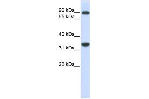 RRP1B antibody used at 1 ug/ml to detect target protein. (RRP1B antibody)