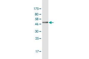 Western Blot detection against Immunogen (37. (ASH1L antibody  (AA 2859-2967))