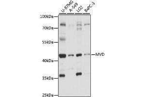 Western blot analysis of extracts of various cell lines, using MVD antibody (ABIN7268505) at 1:1000 dilution. (MVD antibody  (AA 1-270))