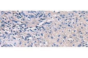 Immunohistochemistry of paraffin-embedded Human brain tissue using PROKR2 Polyclonal Antibody at dilution of 1:40(x200) (Prokineticin Receptor 2 antibody)