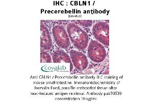 Image no. 2 for anti-Cerebellin 1 Precursor (CBLN1) antibody (ABIN1732717)