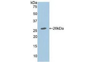 Western blot analysis of recombinant Mouse APC. (APC antibody  (AA 2636-2845))