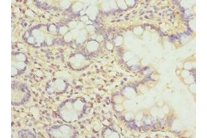 Immunohistochemistry of paraffin-embedded human small intestine tissue using ABIN7147935 at dilution of 1:100 (CLASP1 antibody  (AA 1389-1538))