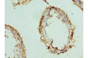 Immunohistochemistry of paraffin-embedded human testis tissue using ABIN7156403 at dilution of 1:100 (CPSF3L antibody  (AA 331-600))
