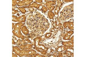 IHC analysis of SELENBP1 using anti-SELENBP1 antibody (ABIN7600755). (SELENBP1 antibody  (AA 23-462))