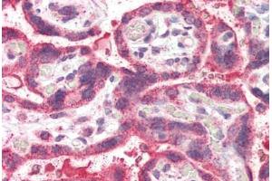 Human Placenta (formalin-fixed, paraffin-embedded) stained with NEIL1 antibody ABIN337008 at 5 ug/ml followed by biotinylated anti-goat IgG secondary antibody ABIN481715, alkaline phosphatase-streptavidin and chromogen. (NEIL1 antibody  (AA 378-390))