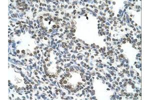 Image no. 1 for anti-Naked Cuticle Homolog 1 (NKD1) (AA 65-114) antibody (ABIN6739155) (NKD1 antibody  (AA 65-114))