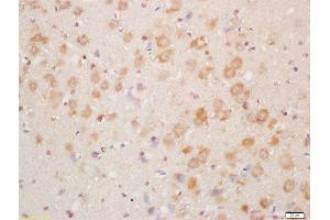 Formalin-fixed and paraffin embedded mouse brain labeled with Rabbit Anti-NDUFA8 Polyclonal Antibody, Unconjugated  at 1:200 followed by conjugation to the secondary antibody and DAB staining (NDUFA8 antibody  (AA 101-172))