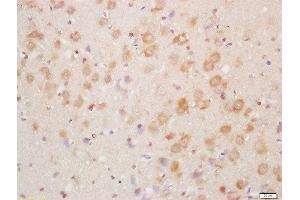 Formalin-fixed and paraffin embedded mouse brain labeled with Rabbit Anti-NDUFA8 Polyclonal Antibody, Unconjugated  at 1:200 followed by conjugation to the secondary antibody and DAB staining