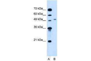 MGAT2 antibody used at 1. (MGAT2 antibody)
