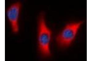 Immunofluorescent analysis of DUSP9 staining in HeLa cells. (DUSP9 antibody)