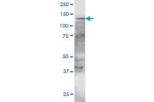 ERN1 monoclonal antibody (M05), clone 4E1 Western Blot analysis of ERN1 expression in HeLa . (ERN1 antibody  (AA 401-500))