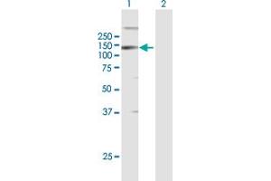Western Blot analysis of LLGL2 expression in transfected 293T cell line by LLGL2 MaxPab polyclonal antibody. (LLGL2 antibody  (AA 1-1020))