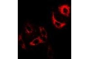 Immunofluorescent analysis of H-FABP staining in U2OS cells. (FABP3 antibody)