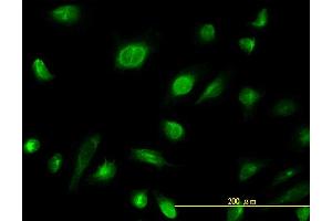 Immunofluorescence of monoclonal antibody to AK1 on HeLa cell.