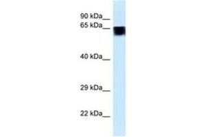 Image no. 1 for anti-Family with Sequence Similarity 161, Member A (FAM161A) (AA 511-560) antibody (ABIN6747442)
