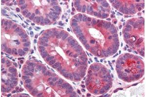 Mouse small intestine: Formalin-Fixed, Paraffin-Embedded (FFPE) (CD36 antibody  (AA 99-114))