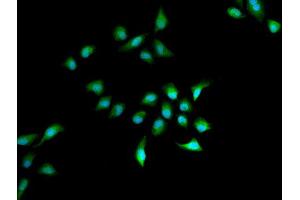 Immunofluorescence analysis of A549 cell using HELLS antibody. (HELLS antibody)