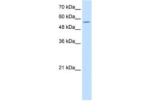 WB Suggested Anti-PDCD4 Antibody   Titration: 10 ug/ml   Positive Control: Jurkat Whole Cell (PDCD4 antibody  (N-Term))