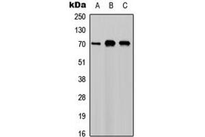 Western blot analysis of M-CSF expression in A549 (A), NS-1 (B), PC12 (C) whole cell lysates. (M-CSF/CSF1 antibody  (C-Term))