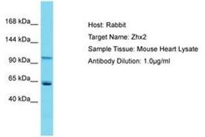 Image no. 1 for anti-Zinc Fingers and Homeoboxes 2 (ZHX2) (AA 703-752) antibody (ABIN6750296) (ZHX2 antibody  (AA 703-752))