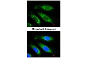 ICC/IF Image Immunofluorescence analysis of paraformaldehyde-fixed HeLa, using Beta-ETF, antibody at 1:200 dilution. (ETFB antibody)