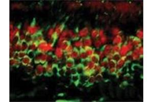 Image no. 1 for anti-DNA (Cytosine-5-)-Methyltransferase 3 alpha (DNMT3A) (AA 705-908), (C-Term) antibody (ABIN207958) (DNMT3A antibody  (C-Term))