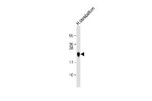 Anti MBP Antibody  at 1:16000 dilution + human cerebellum lysate Lysates/proteins at 20 μg per lane. (MBP antibody  (AA 177-209))