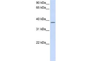 Western Blotting (WB) image for anti-Chromosome 21 Open Reading Frame 91 (C21orf91) antibody (ABIN2458966) (C21orf91 antibody)