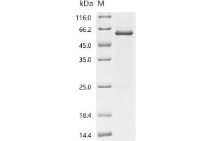 (Tris-Glycine gel) Discontinuous SDS-PAGE (reduced) with 5 % enrichment gel and 15 % separation gel.