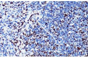 Immunohistochemistry (Paraffin-embedded Sections) (IHC (p)) image for anti-Histone H2B (acLys5) antibody (ABIN7258524)