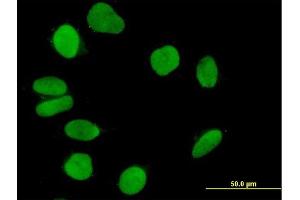 Immunofluorescence of purified MaxPab antibody to IQWD1 on HeLa cell. (DCAF6 antibody  (AA 1-513))