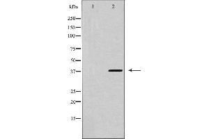 Western blot analysis of CXCR4 expression in K562 cells,The lane on the left is treated with the antigen-specific peptide.