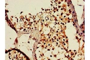 IHC image of ABIN7150995 diluted at 1:600 and staining in paraffin-embedded human testis tissue performed on a Leica BondTM system. (CBL antibody  (AA 548-847))