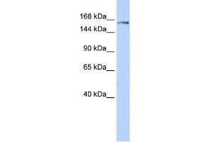 WB Suggested Anti-EPRS Antibody Titration:  0. (EPRS antibody  (Middle Region))