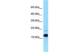 WB Suggested Anti-BRI3 Antibody Titration: 1. (BRI3 antibody  (N-Term))