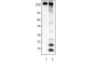 Image no. 1 for anti-Acetylated Lysine antibody (ABIN300042) (Acetylated Lysine antibody)