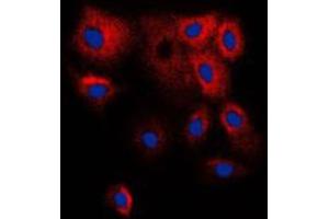Immunofluorescent analysis of Cytochrome P450 2B6 staining in HepG2 cells. (CYP2B6 antibody  (Center))