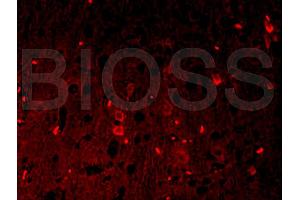 Formalin-fixed and paraffin-embedded rat brain labeled with Anti-? (beta Catenin antibody  (AA 661-781))