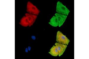 ABIN7096231 and ABIN7100293 staining  cells by IF/ICC.
