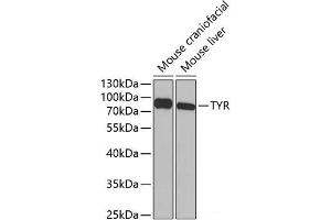 Western blot analysis of extracts of various cell lines using TYR Polyclonal Antibody at dilution of 1:1000.