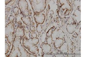 Image no. 1 for anti-Suppressor of Cytokine Signaling 5 (SOCS5) (AA 1-110) antibody (ABIN599092) (SOCS5 antibody  (AA 1-110))