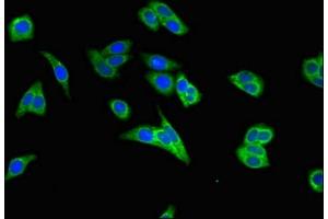 Immunofluorescent analysis of HepG2 cells using ABIN7150701 at dilution of 1:100 and Alexa Fluor 488-congugated AffiniPure Goat Anti-Rabbit IgG(H+L) (MEK2 antibody  (AA 264-400))