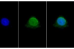 Immunofluorescence (IF) image for anti-Histone Deacetylase 6 (HDAC6) (AA 560-811) antibody (ABIN7439288)