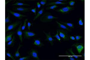 Immunofluorescence of purified MaxPab antibody to AK3L1 on HeLa cell. (AK4 antibody  (AA 1-223))