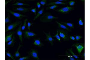 Immunofluorescence of purified MaxPab antibody to AK3L1 on HeLa cell. (AK4 antibody  (AA 1-223))